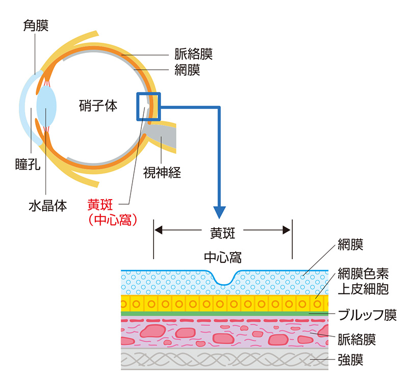 画像：加齢黄斑変性